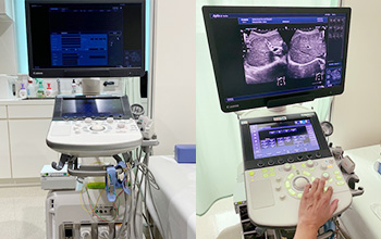 最新の超音波診断装置