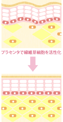 無呼吸症候群のリスク