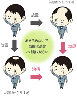 無呼吸症候群のリスク